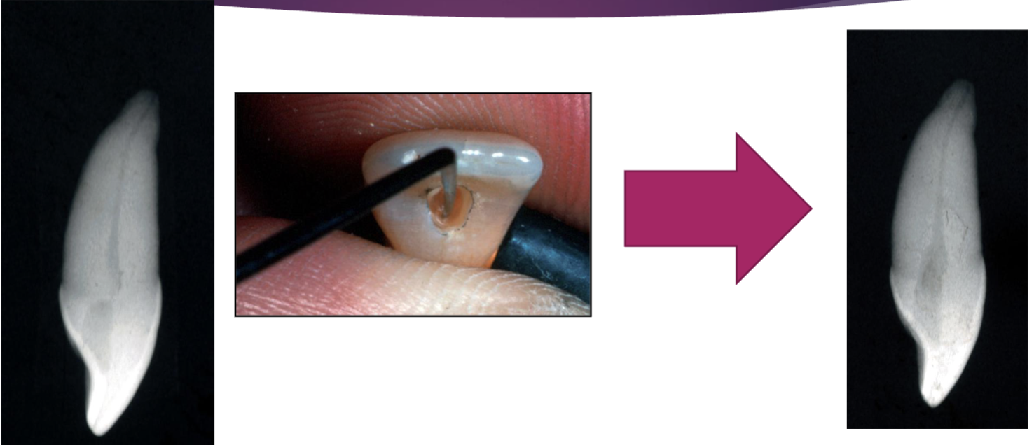 <p>what to find orifice, feel what you need to open more, if explorer doesn’t fit, need to open more </p>