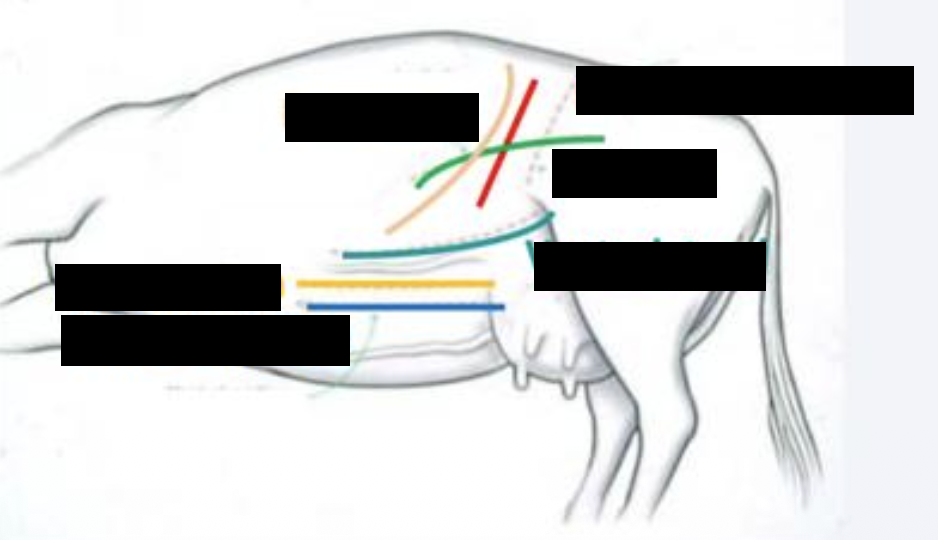 <p>what surgical approach is the dark blue line?</p>