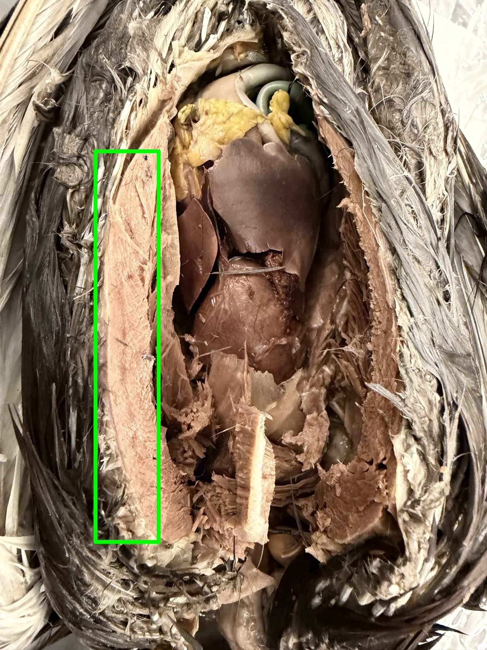<p>What muscle?</p>