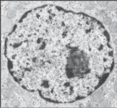 <p>Identify the following structures in electron micrograph (the whole structure)</p>