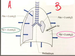 <p>Which one of these show the pneumothorax?</p>