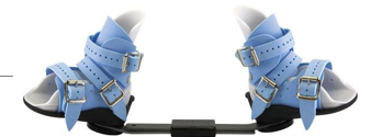 <p>Ponseti AFO and Abduction Bar </p><p>treatment for clubfoot </p>