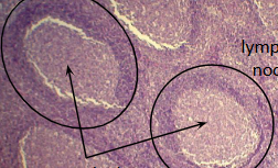 <p>what are the arrows pointing to?</p>