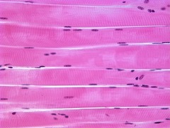 <p>Location: Skeletal Muscles</p><p>Function: Voluntary movement</p>