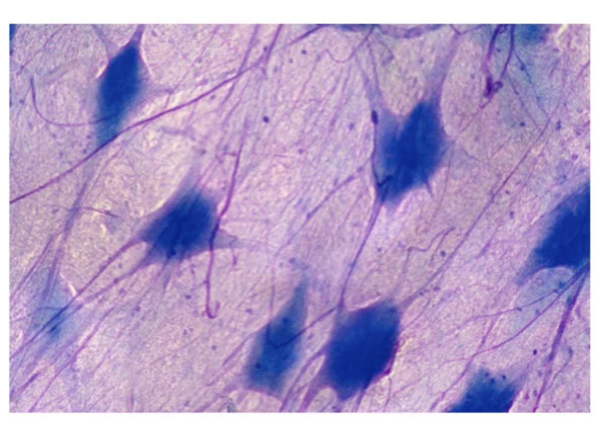 <p>Multipolar Neuron : Function : Transmits nerve impulses between the brain, spinal cord, muscles, and glands.</p>