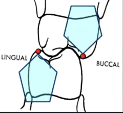 <p>- cusps that overlap and in some instances guide the supporting cusps into occlusion</p><p>- buccal of the maxillary</p><p>- lingual of the mandibular</p>