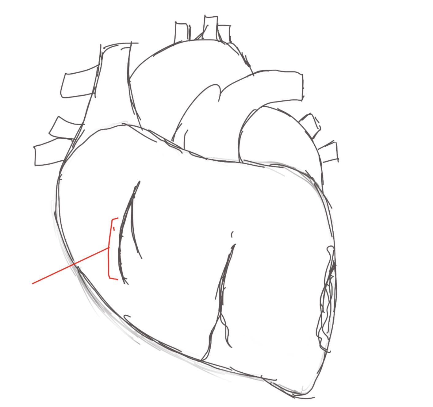 <p>structure. to lateral wall of right ventricle</p>