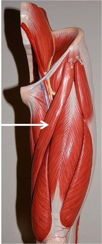 <p>Muscle, Origin, Insertion, Action. Perform the action on your own body</p>