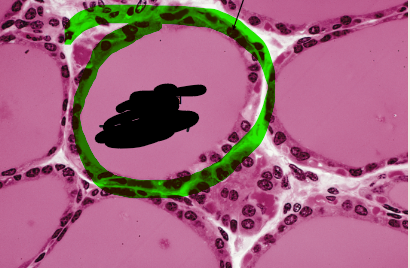 <p>what is the green</p>