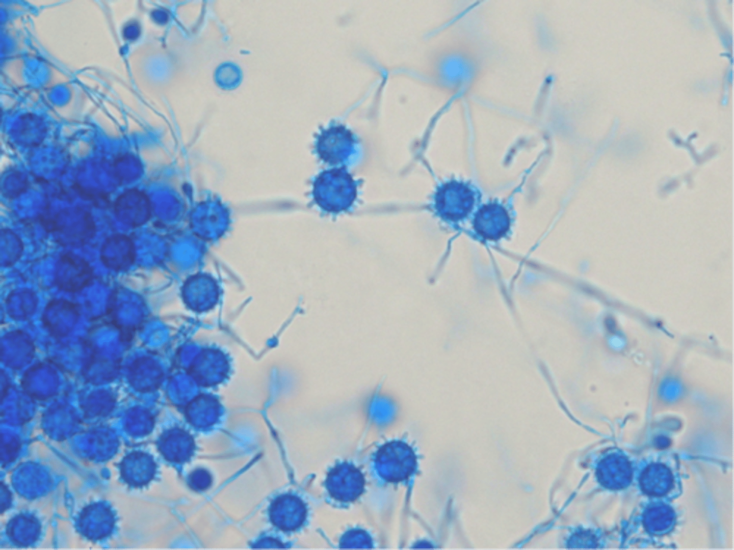 <p>Stains fungal cell walls blue</p>