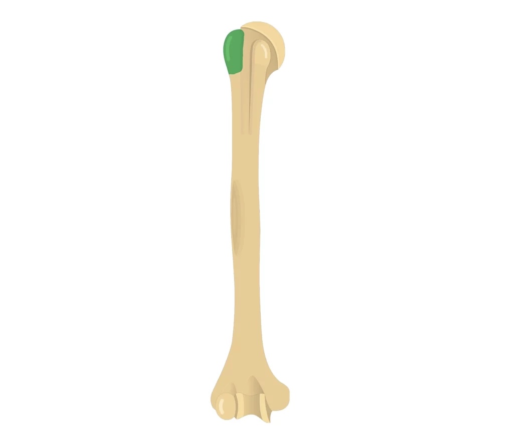 <p>A large prominence on the proximal humerus.</p>