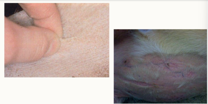 <ol><li><p>protein catabolism (atrophic collagen) and loss of subcutaneous fat</p></li><li><p>inhibition of fibroblast proliferation and collagen synthesis</p></li></ol><p></p>