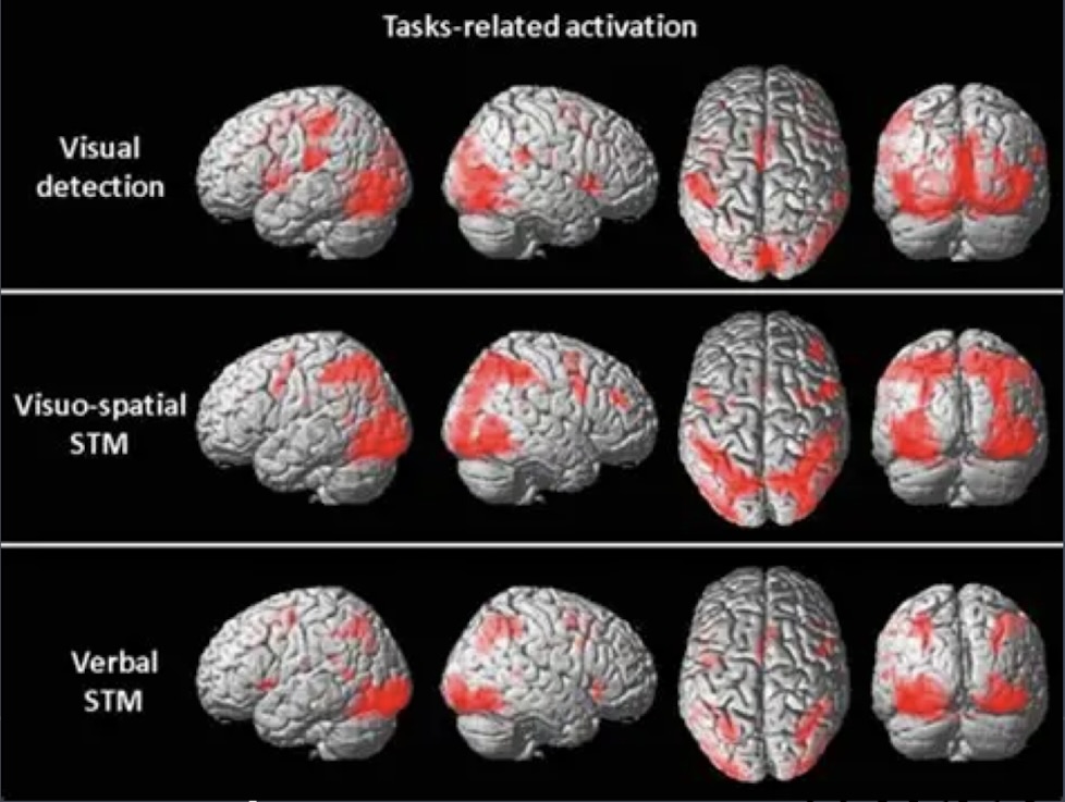 <p>lot of areas involved: </p><ul><li><p>right hemisphere</p></li><li><p>occipital lobe </p></li><li><p>frontal cortex</p></li><li><p>frontal and parietal lobes</p></li></ul><p>noticeably not the front left cortex</p><p></p>