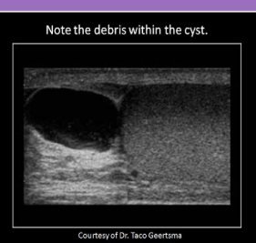 term image