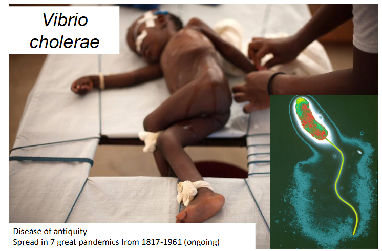 <p>Vibrio Cholerae</p>