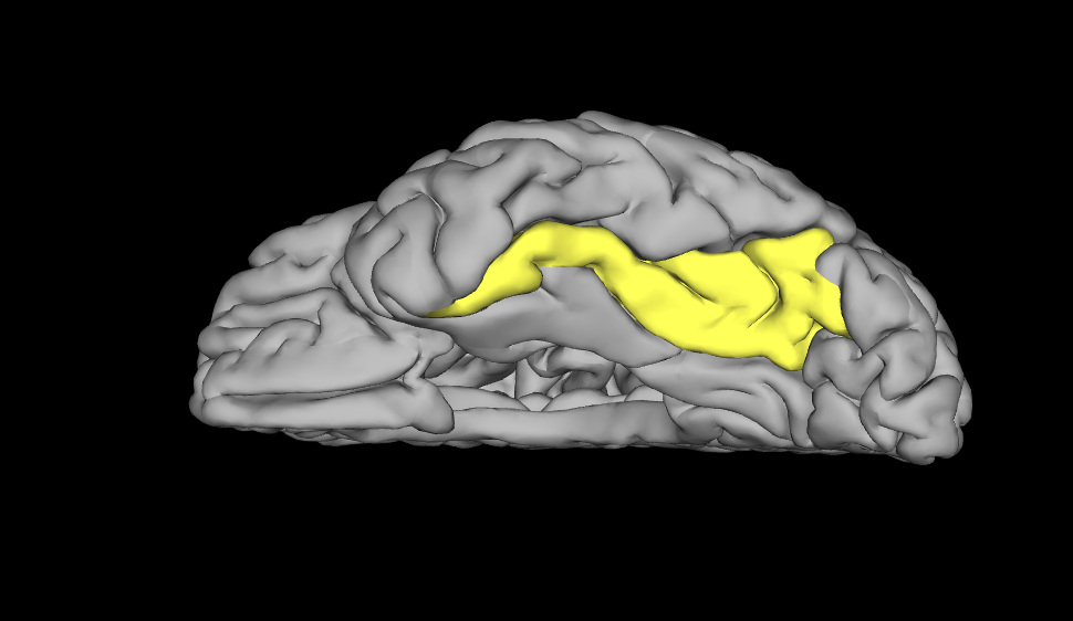 <p>What area of the brain is this </p>
