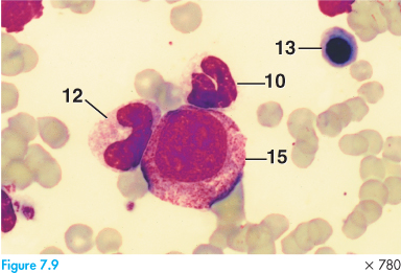 <p>Eosin + methylene blue to differentiate blood cell types</p>