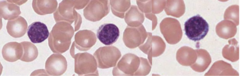 <p>The round dark purple nucleus takes up almost all of the cell. Only a slight "halo" of cytoplasm is visible. </p><p>Small 'crescent' of light cytoplasm. Large, round nucleus. About the same size as surrounding RBCs. </p><p>Agranulocytes. </p><p>20-45% frequency in the blood</p>
