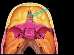 <p>cribriform plate</p>