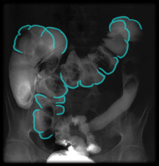<p>identify the structure</p>