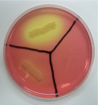 <p>given the picture, give me the interpretations</p>