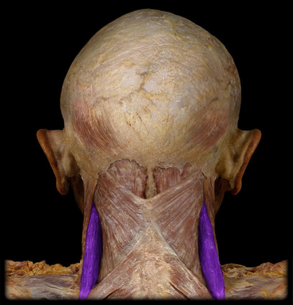 <p>Duplicate view.</p>