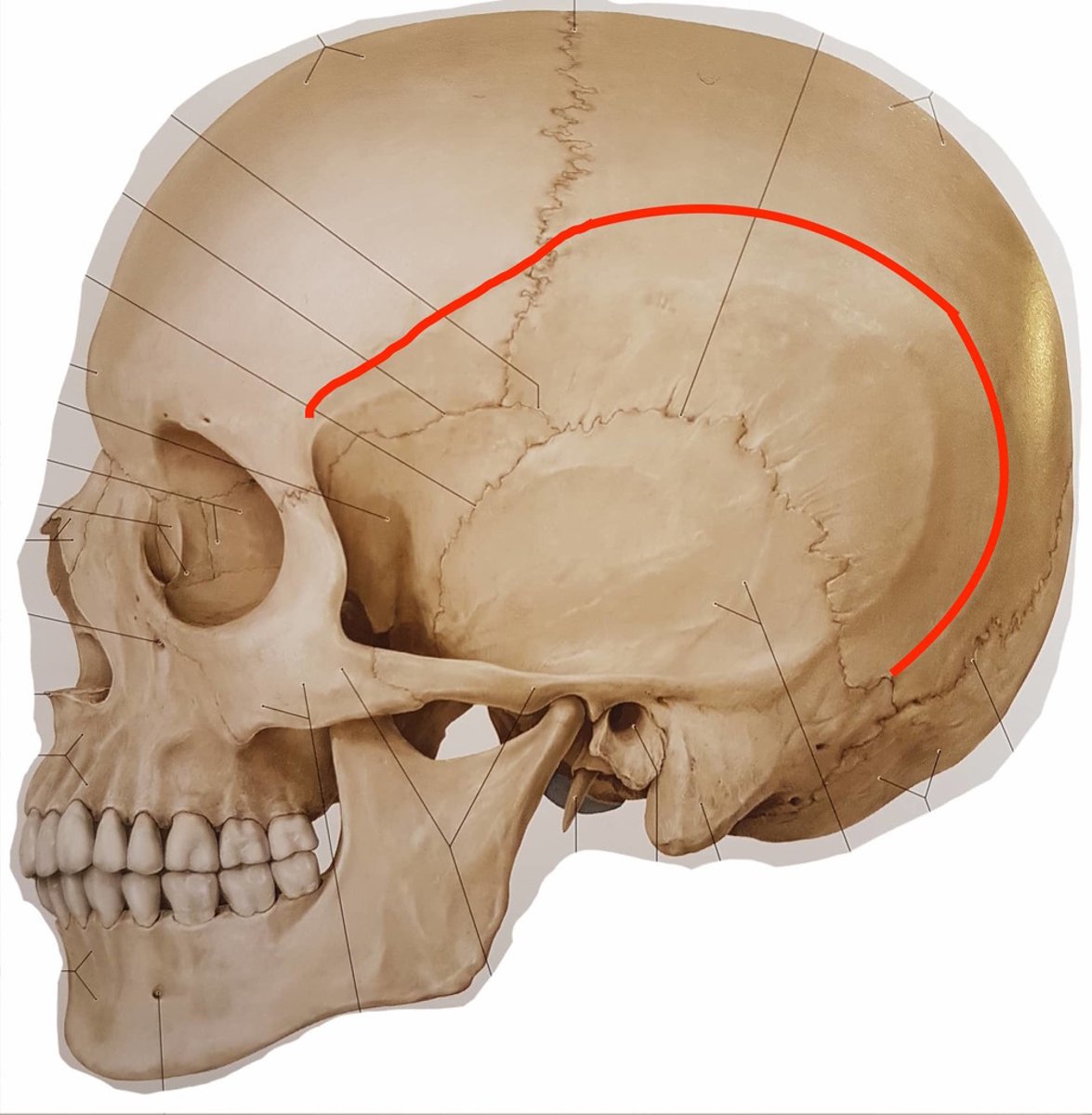 <p>grens tussen het voorhoofd en de fossa temporalis</p>