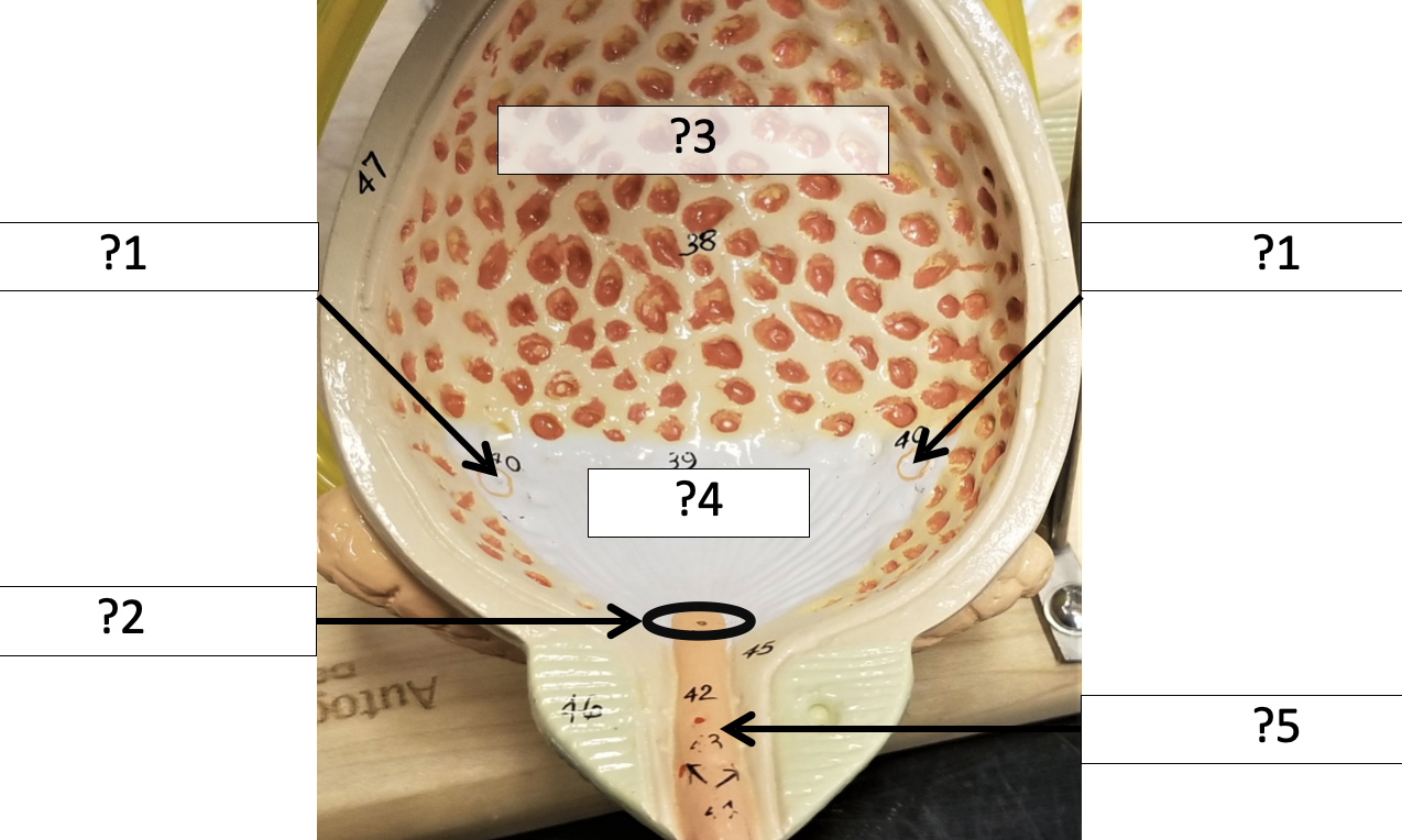 <p>1 Name the hole?</p>