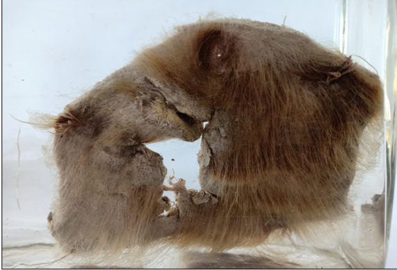<p>Questions</p><ol><li><p>What is the specimen being examined?</p></li><li><p>What are the descriptive features of the injury on the scalp?</p></li><li><p>What is the likely causative instrument for this type of injury?</p></li><li><p>How is the time of death estimated in relation to the injury?</p></li><li><p>What are the possible causes of death?</p></li><li><p>What is the final diagnosis for this specimen?</p></li></ol><div data-type="horizontalRule"><hr></div><p></p>