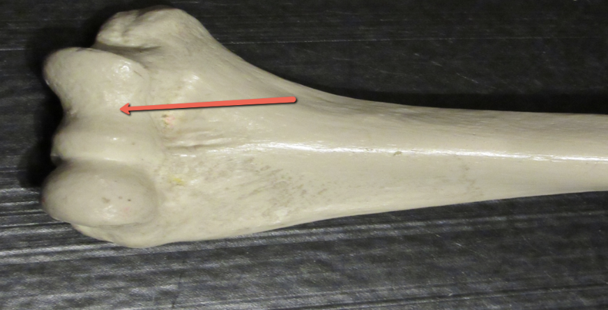 <p><span><strong>Identify the bone marking indicated by the pointer.</strong></span></p>