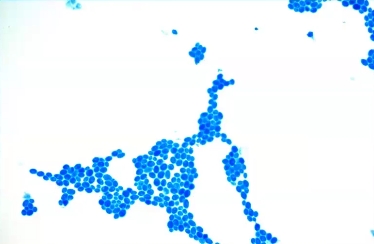 <p>What is a simple stain? Name the commonly used simple stain. </p>