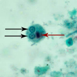 term image