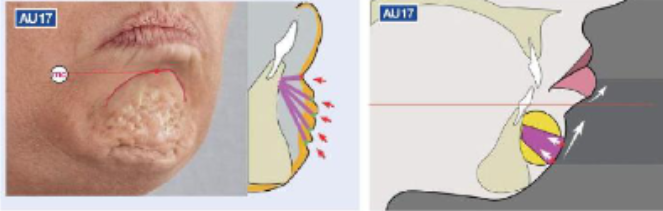 <p>chin raiser</p>