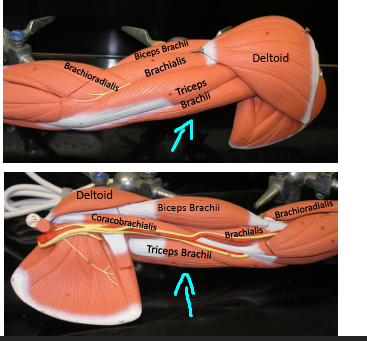 <p><strong>Origin: </strong>Posterior humerus.<strong><br>Insertion: </strong>Olecranon process of ulna.<strong><br>Action: </strong>Extends forearm.</p><p><span style="color: rgb(221, 6, 6);"><strong>Antagonist: </strong></span><span style="color: rgb(248, 248, 248);">Biceps brachii.</span></p>