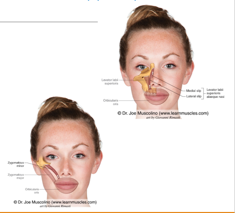 <p>Levator labii superioris</p><p>Zygomatic minor</p><p>Levator labii superioris alaeque nasi</p><p>All innervated by VII Facial</p>