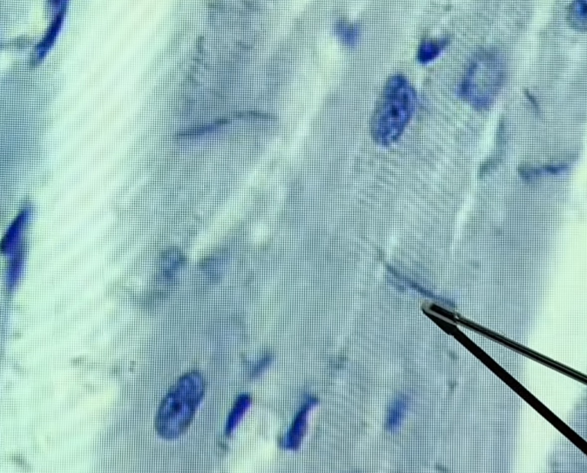 <p>What type of cell and what is the arrow pointing at? </p>