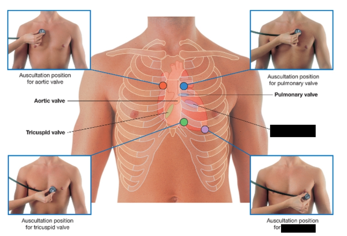 <p><span>a crucial one-way gate in the heart located between the left atrium and the left ventricle. It opens to let oxygen-rich blood flow into the main pumping chamber and closes tightly to prevent blood from leaking backward into the lungs.</span></p>