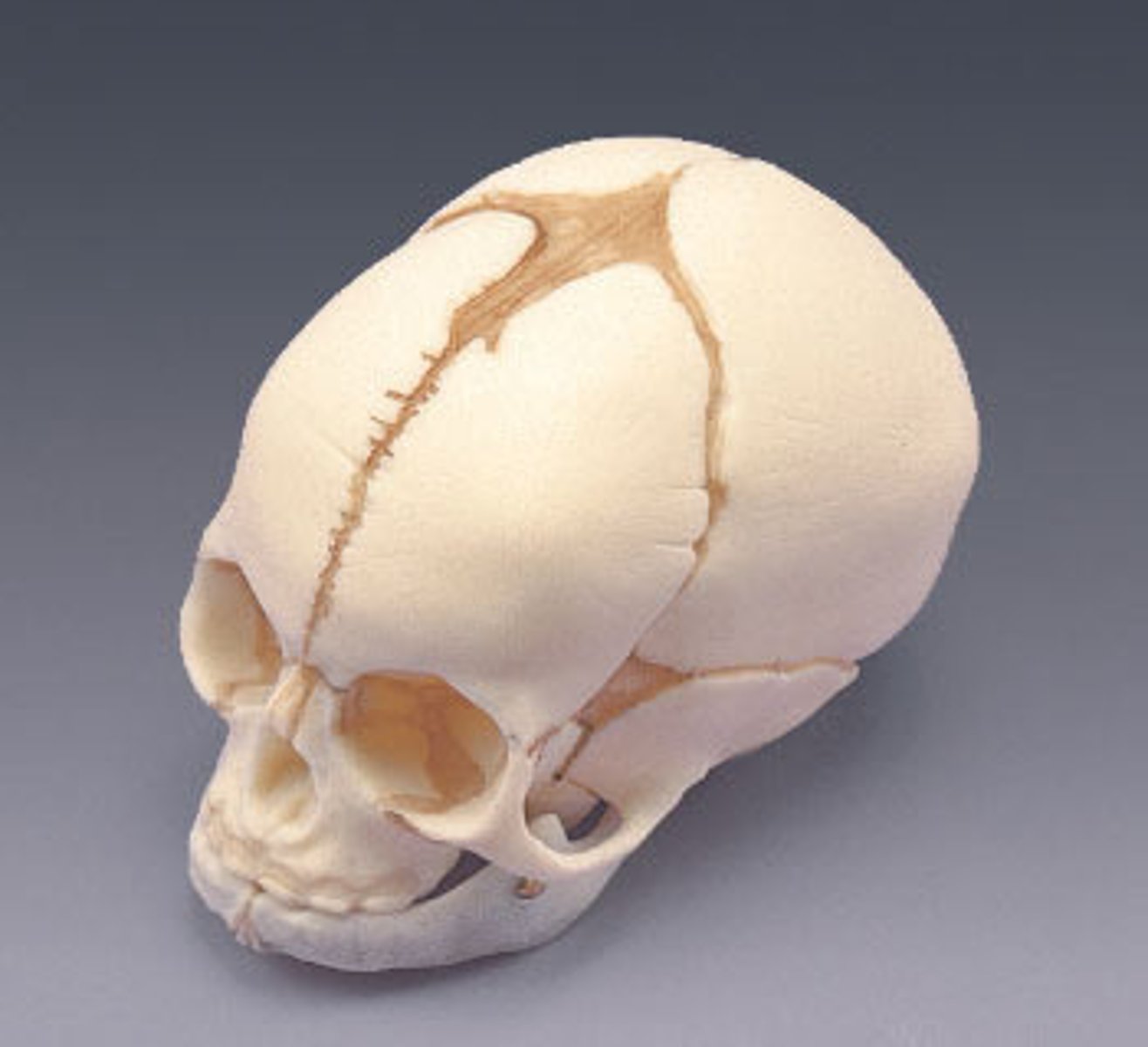 <p>{TYPE OF SKULL}</p>
