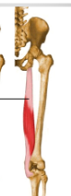 <ul><li><p><span style="background-color: transparent;">A: flexion @ knee; flexion &amp; medial rotation hip</span></p></li></ul><p></p>