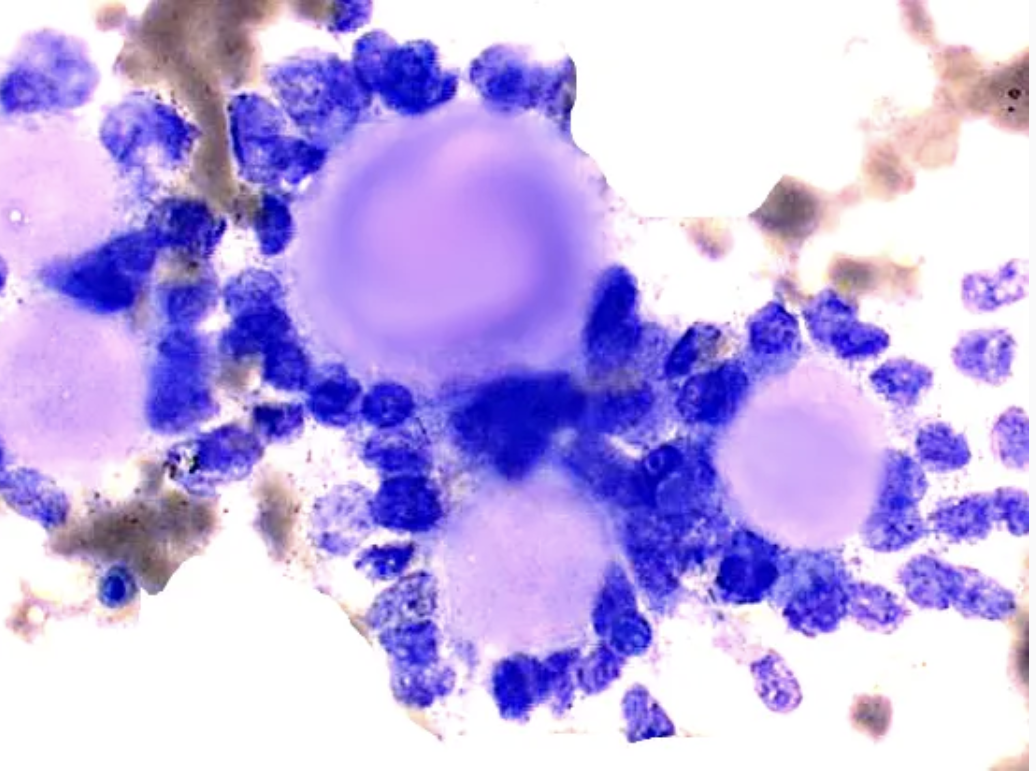 <p>Cytologie salivaire</p><p>1) Catégorie selon Milan</p><p>2) Diagnostic</p>