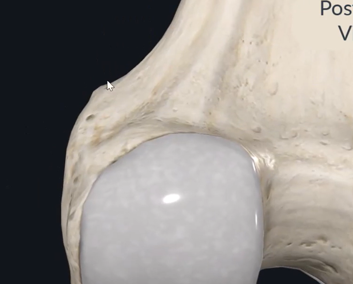 <p>what is the name of this small protruding bump on the medial side of the distal femur when viewed from a posterior aspect?</p>