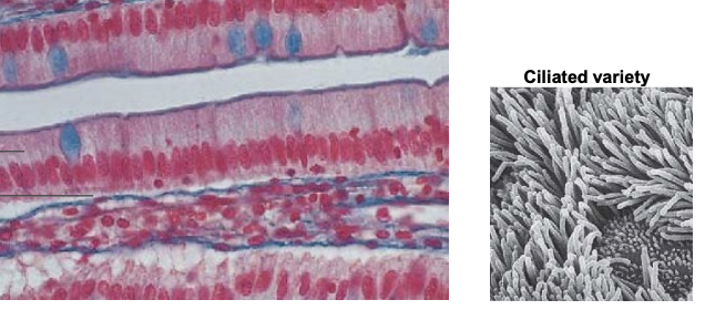 <p>what epithelial tissue is this? what are its functions? What distinguishes it structurally? where is it in the body?</p>