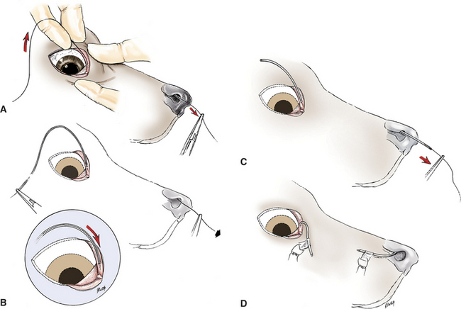 nasolacrimnal duct stenting/catheterisation