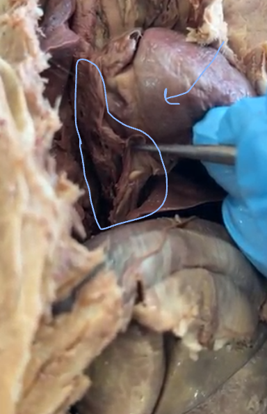 <p>inferior vena cava</p>