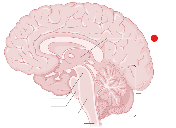 <p>Identify the structure pinned</p>