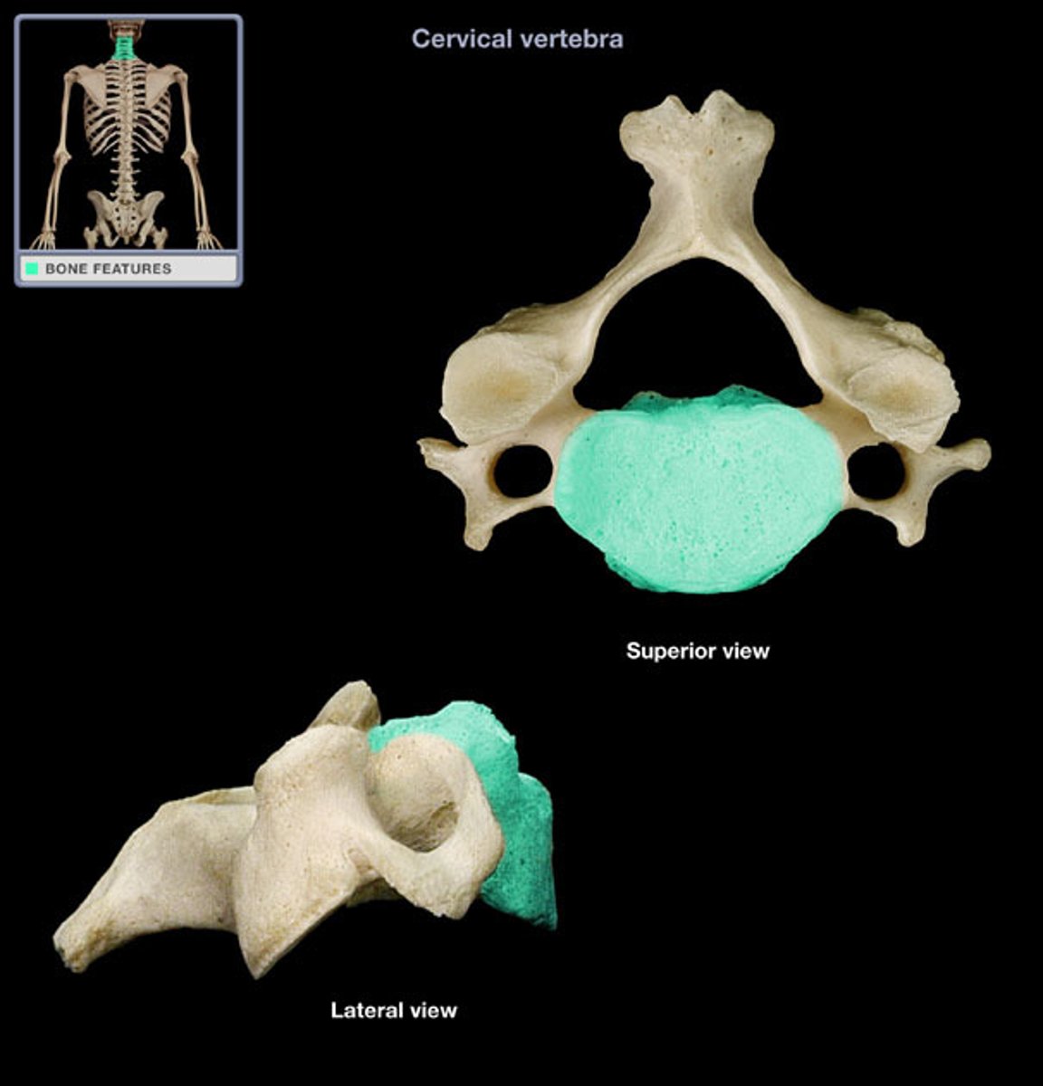 <p>(name of the vertebra part)</p>