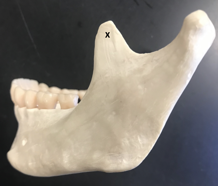 <p><span>Identify the structure labeled "X"</span></p>
