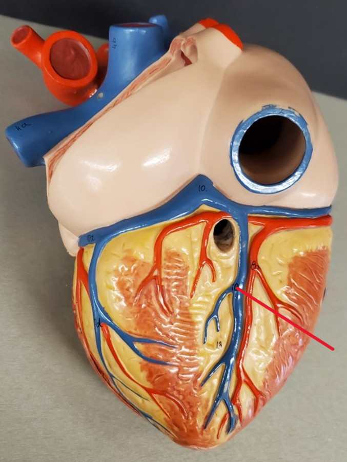 <p>Name the vein</p>