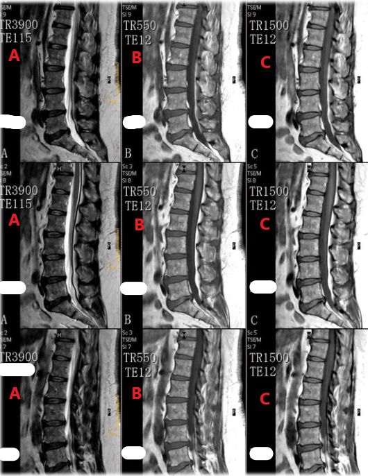 <p>Which row of these images are T2 weighted ?</p>