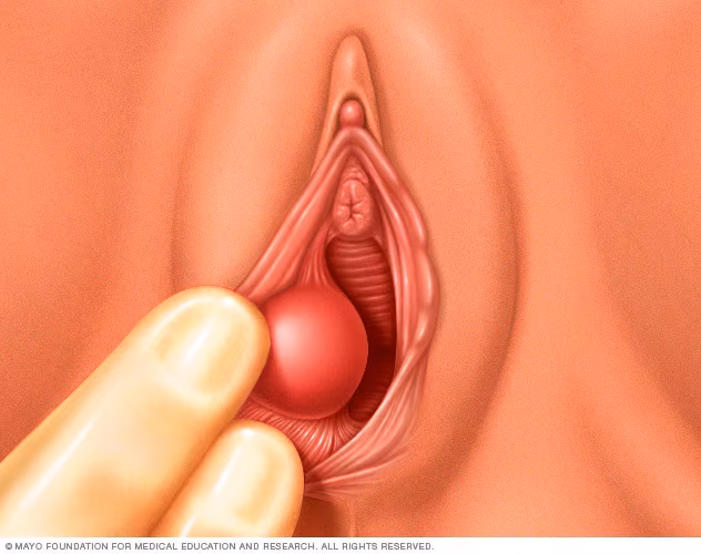 <p>What is this condition?</p>